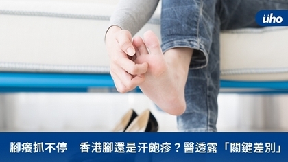 腳癢抓不停 香港腳還是汗皰疹?醫透露「關鍵差別」