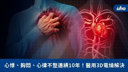 心悸、胸悶、心律不整連續10年!醫用3D電燒解決