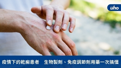 疫情下的乾癬患者 生物製劑、免疫調節劑用藥一次搞懂