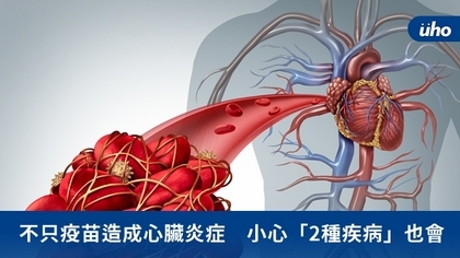 不只疫苗造成心臟炎症 小心「2種疾病」也會