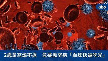 2歲童高燒不退 竟罹患罕病「血球快被吃光」