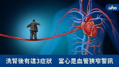 洗腎後有這3症狀 當心是血管狹窄警訊