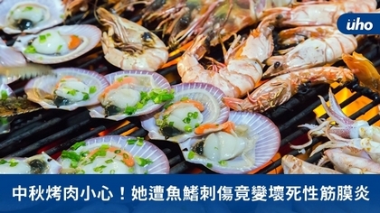 中秋烤肉小心!她遭魚鰭刺傷竟變壞死性筋膜炎