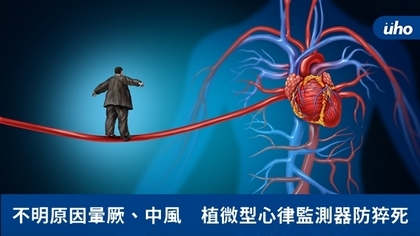 不明原因暈厥、中風 植微型心律監測器防猝死