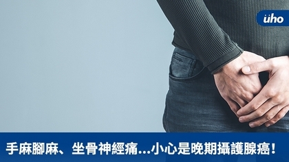 手麻腳麻、坐骨神經痛...小心是晚期攝護腺癌!