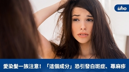 愛染髮一族注意!「這個成分」恐引發白斑症、蕁麻疹