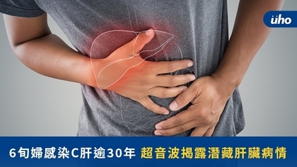 6旬婦感染C肝逾30年 超音波揭露潛藏肝臟病情