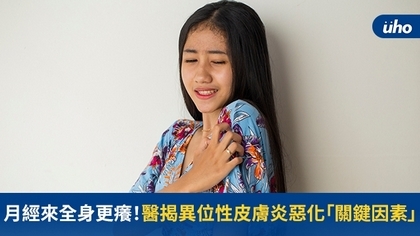 月經來全身更癢!醫揭異位性皮膚炎惡化「關鍵因素」