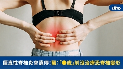 僵直性脊椎炎會遺傳!醫:「●歲」前沒治療恐脊椎變形