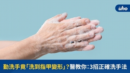 勤洗手竟「洗到指甲變形」?醫教你:3招正確洗手法