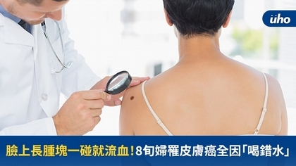 臉上長腫塊一碰就流血!8旬婦罹皮膚癌全因「喝錯水」