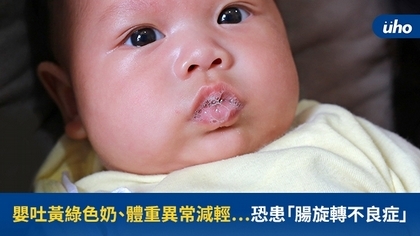 嬰吐黃綠色奶、體重異常減輕⋯恐患「腸旋轉不良症」