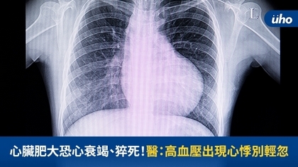 心臟肥大恐心衰竭、猝死!醫:高血壓出現心悸別輕忽