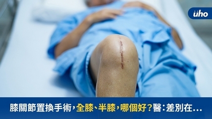 膝關節置換手術,全膝、半膝,哪個好?醫:差別在⋯