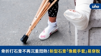 骨折打石膏不再沉重悶熱!新型石膏「像戴手套」易穿脫