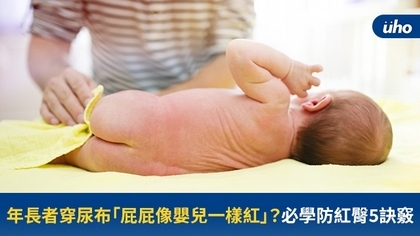 年長者穿尿布「屁屁像嬰兒一樣紅」?必學防紅臀5訣竅