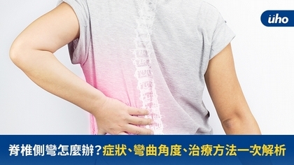 脊椎側彎怎麼辦？症狀、彎曲角度、治療方法一次解析