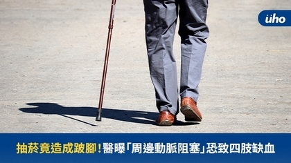 抽菸竟造成跛腳!醫曝「周邊動脈阻塞」恐致四肢缺血