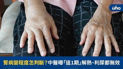 腎病變程度怎判斷?中醫曝「這1期」解熱、利尿已無效