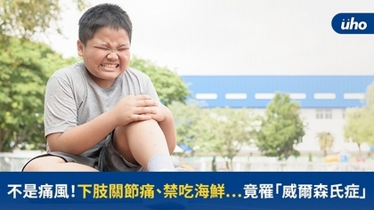 不是痛風!下肢關節痛、禁吃海鮮⋯竟罹「威爾森氏症」