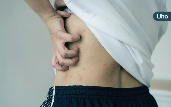 冬季癢靠清潔能改善？醫揭「3大壞習慣」越洗越乾：洗澡洗太久也算