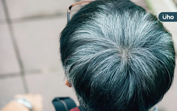 曬太陽容易長白頭髮？日本專家列頭皮保養法：防曬乳挑選「這1種」