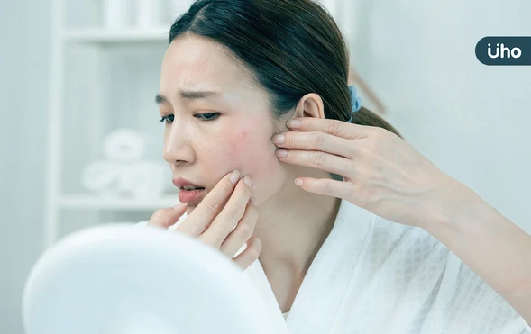 為什麼臉上長滿痘痘？青春痘成因、保養方法一次看：避免過度清潔