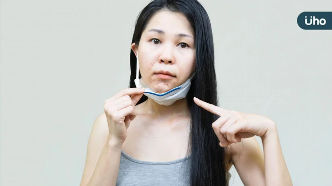 多囊性卵巢反覆失調？中醫辨證調理體質，助攻月經規律與好孕力